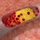Wpływ produktów utleniania cholesterolu na organizm człowieka
